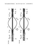 MEDICAL DEVICE AND TREATMENT METHOD diagram and image