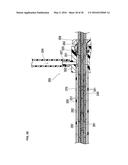 MEDICAL DEVICE AND TREATMENT METHOD diagram and image