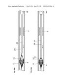 MEDICAL DEVICE AND TREATMENT METHOD diagram and image