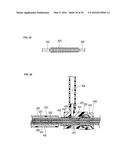 MEDICAL DEVICE AND TREATMENT METHOD diagram and image