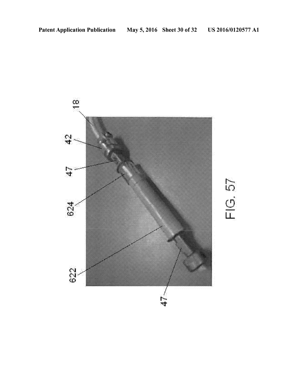 FLEXIBLE SPINE STABILIZATION SYSTEM - diagram, schematic, and image 31