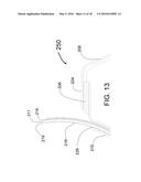 TRANSVASCULAR METHODS OF TREATING EXTRAVASCULAR TISSUE diagram and image