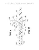 TRANSVASCULAR METHODS OF TREATING EXTRAVASCULAR TISSUE diagram and image