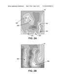 ABLATION THERAPY TO DISRUPT COORDINATED BLADDER CONTRACTIONS diagram and image