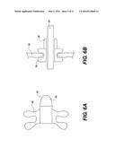 METHODS AND DEVICES FOR CREATING AN OPENING THROUGH AN ANATOMIC WALL diagram and image