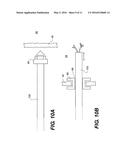 METHODS AND DEVICES FOR CREATING AN OPENING THROUGH AN ANATOMIC WALL diagram and image