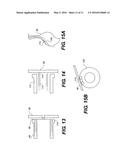 METHODS AND DEVICES FOR CREATING AN OPENING THROUGH AN ANATOMIC WALL diagram and image