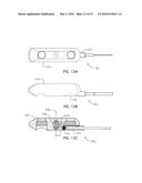 MEDICAL DEVICES, APPARATUSES, SYSTEMS AND METHODS diagram and image