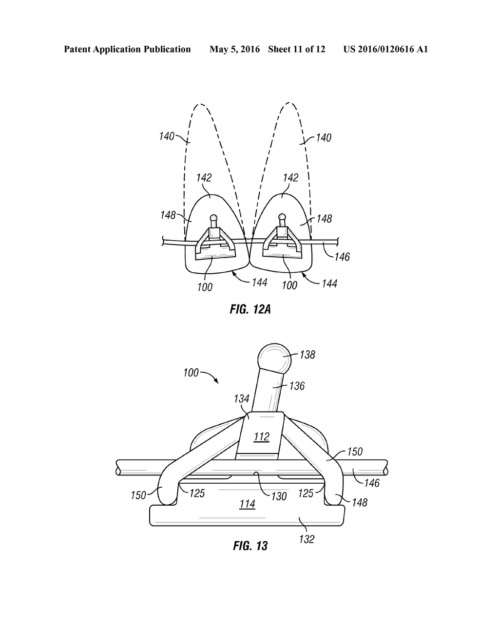 METHOD AND APPARATUS FOR TREATING ORTHODONTITIS - diagram, schematic, and image 12