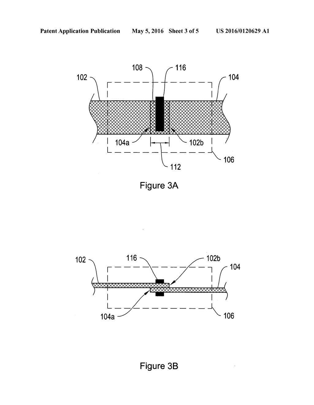 TENSION-ADJUSTABLE SURGICAL SLING ASSEMBLY - diagram, schematic, and image 04