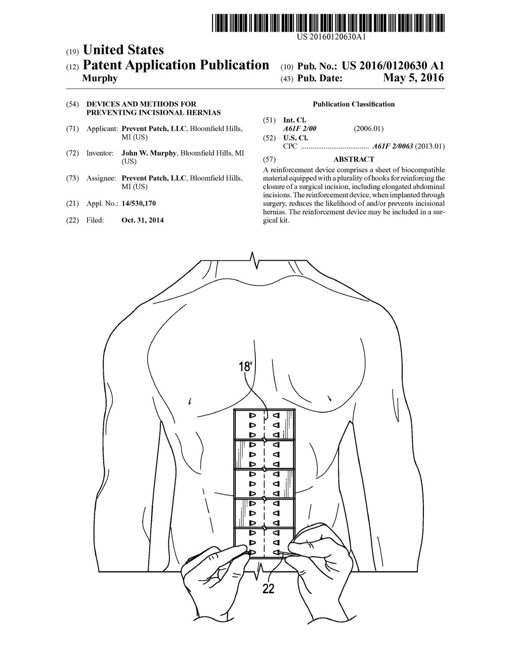 DEVICES AND METHODS FOR PREVENTING INCISIONAL HERNIAS - diagram, schematic, and image 01