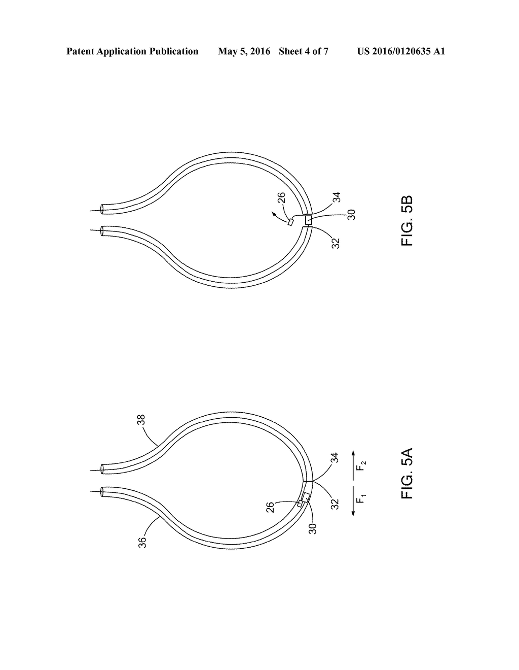 LOOP VASCULAR DEVICE AND METHOD TO RETRIEVE - diagram, schematic, and image 05