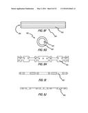 HEART AND PERIPHERAL VASCULAR VALVE REPLACEMENT IN CONJUNCTION WITH A     SUPPORT RING diagram and image