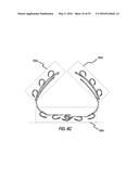 HEART AND PERIPHERAL VASCULAR VALVE REPLACEMENT IN CONJUNCTION WITH A     SUPPORT RING diagram and image