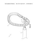 HEART AND PERIPHERAL VASCULAR VALVE REPLACEMENT IN CONJUNCTION WITH A     SUPPORT RING diagram and image