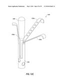 HEART AND PERIPHERAL VASCULAR VALVE REPLACEMENT IN CONJUNCTION WITH A     SUPPORT RING diagram and image