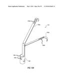 HEART AND PERIPHERAL VASCULAR VALVE REPLACEMENT IN CONJUNCTION WITH A     SUPPORT RING diagram and image