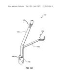 HEART AND PERIPHERAL VASCULAR VALVE REPLACEMENT IN CONJUNCTION WITH A     SUPPORT RING diagram and image