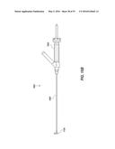 HEART AND PERIPHERAL VASCULAR VALVE REPLACEMENT IN CONJUNCTION WITH A     SUPPORT RING diagram and image