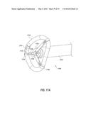 HEART AND PERIPHERAL VASCULAR VALVE REPLACEMENT IN CONJUNCTION WITH A     SUPPORT RING diagram and image