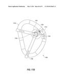 HEART AND PERIPHERAL VASCULAR VALVE REPLACEMENT IN CONJUNCTION WITH A     SUPPORT RING diagram and image