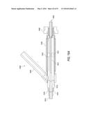 HEART AND PERIPHERAL VASCULAR VALVE REPLACEMENT IN CONJUNCTION WITH A     SUPPORT RING diagram and image