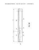 HEART AND PERIPHERAL VASCULAR VALVE REPLACEMENT IN CONJUNCTION WITH A     SUPPORT RING diagram and image