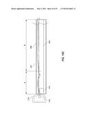 HEART AND PERIPHERAL VASCULAR VALVE REPLACEMENT IN CONJUNCTION WITH A     SUPPORT RING diagram and image