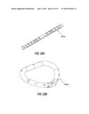 HEART AND PERIPHERAL VASCULAR VALVE REPLACEMENT IN CONJUNCTION WITH A     SUPPORT RING diagram and image