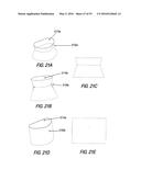 HEART AND PERIPHERAL VASCULAR VALVE REPLACEMENT IN CONJUNCTION WITH A     SUPPORT RING diagram and image