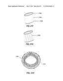 HEART AND PERIPHERAL VASCULAR VALVE REPLACEMENT IN CONJUNCTION WITH A     SUPPORT RING diagram and image