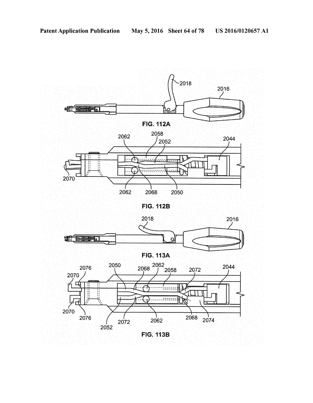 SYSTEMS AND APPARATUSES FOR SECURING AN IMPLANT IN INTERVERTEBRAL SPACE - diagram, schematic, and image 65