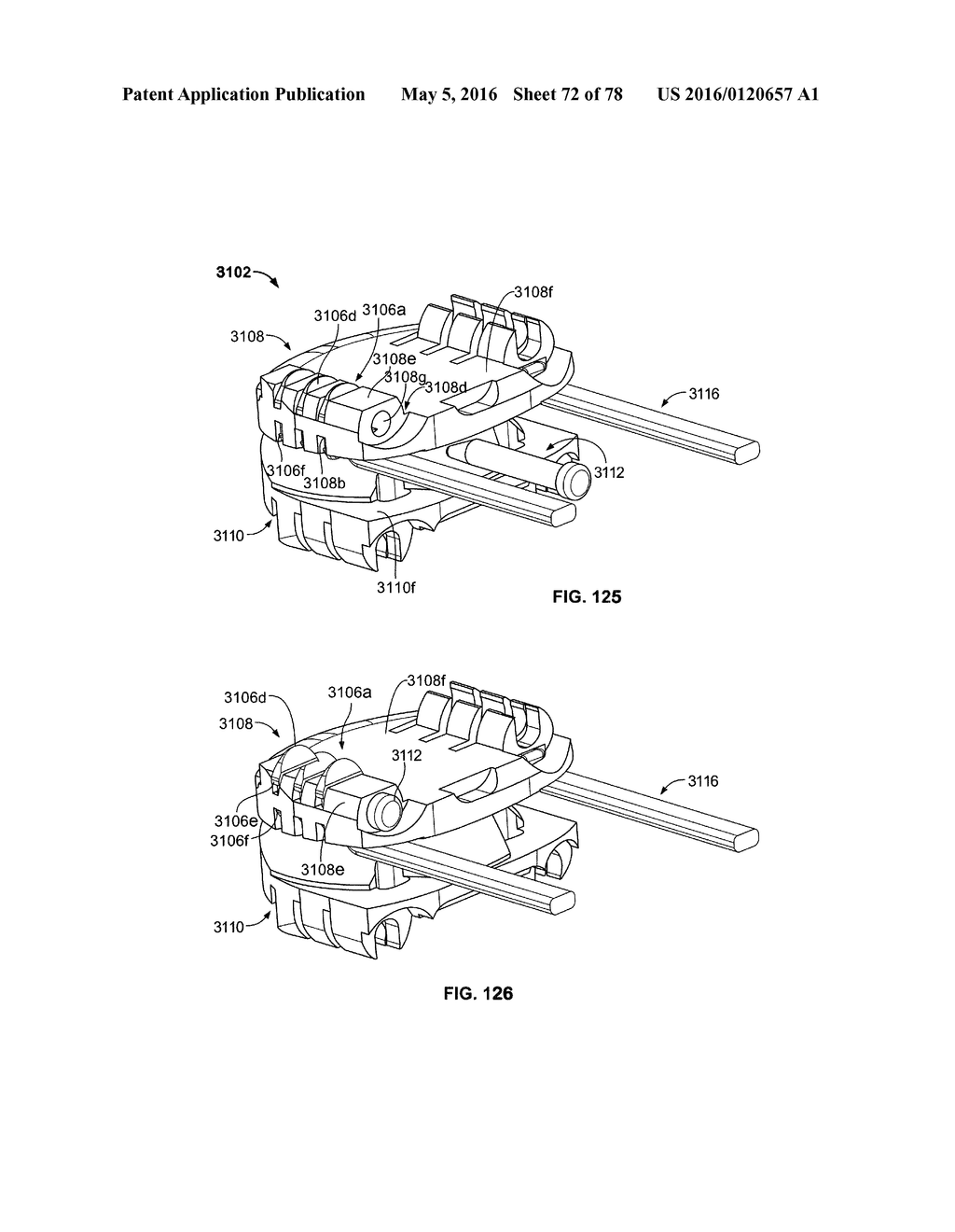 SYSTEMS AND APPARATUSES FOR SECURING AN IMPLANT IN INTERVERTEBRAL SPACE - diagram, schematic, and image 73