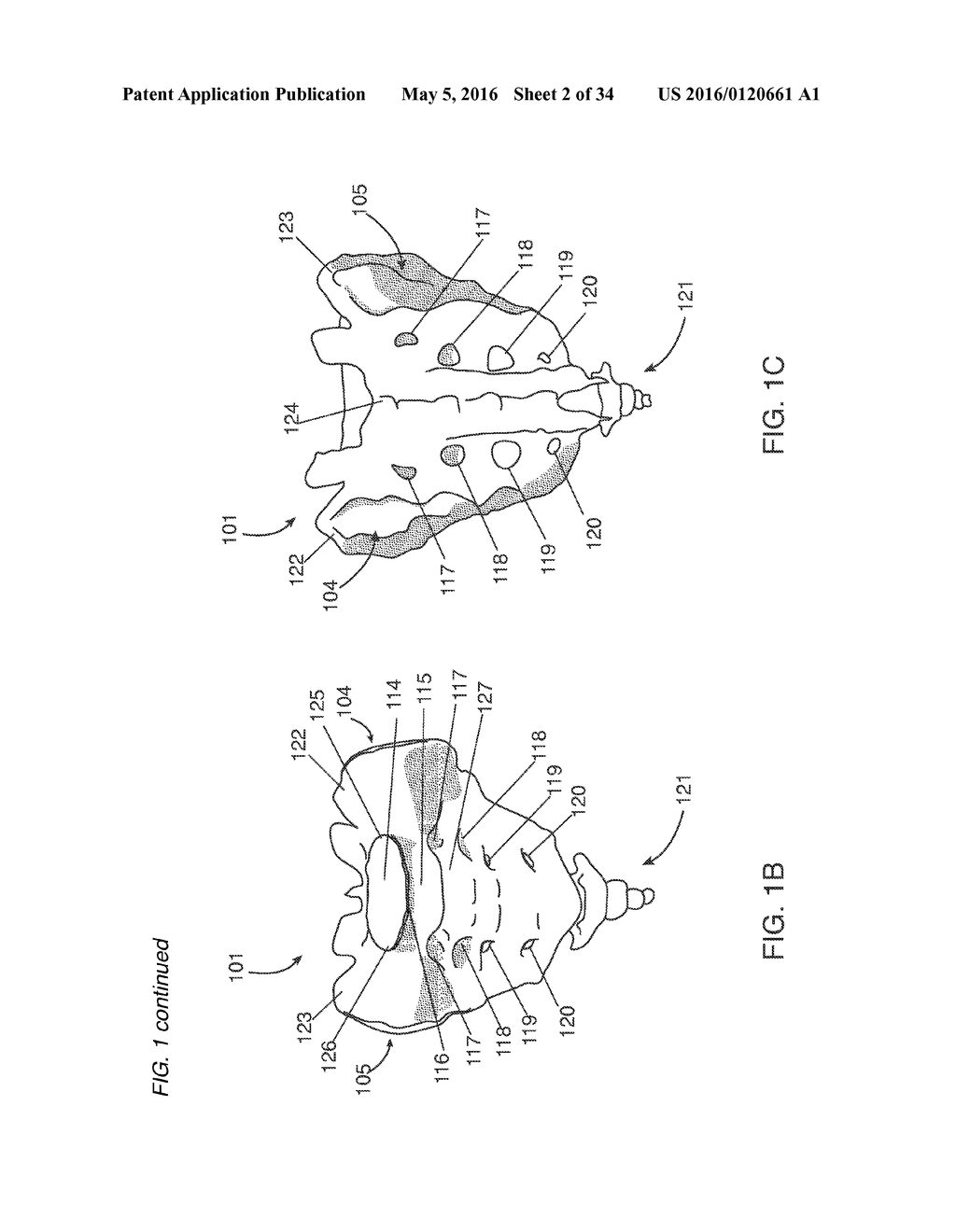 Minimally invasive approaches, methods and apparatuses to accomplish     sacroiliac fusion - diagram, schematic, and image 03