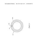 RAPID EXCHANGE STENT DELIVERY SYSTEM diagram and image