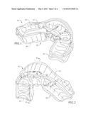 DENTAL MOUTHPIECE FOR TREATING SNORING OR APNEA AND METHOD OF ASSEMBLY diagram and image