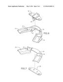 DENTAL MOUTHPIECE FOR TREATING SNORING OR APNEA AND METHOD OF ASSEMBLY diagram and image