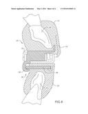DENTAL MOUTHPIECE FOR TREATING SNORING OR APNEA AND METHOD OF ASSEMBLY diagram and image