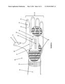 NORMOTHERMIC MAINTENANCE METHOD AND SYSTEM diagram and image