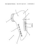 NORMOTHERMIC MAINTENANCE METHOD AND SYSTEM diagram and image