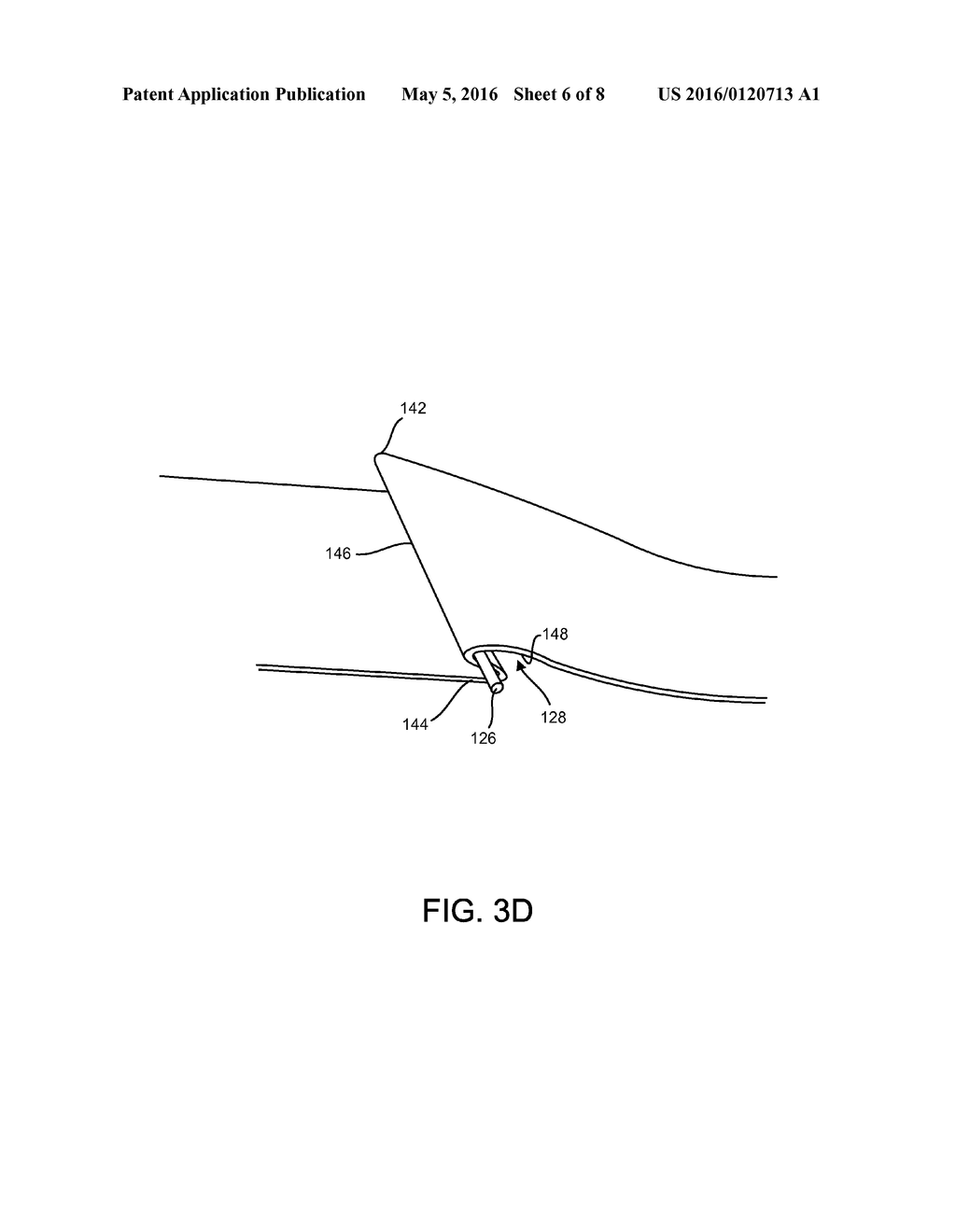 PROTECTIVE COVERING FOR A PATIENT - diagram, schematic, and image 07