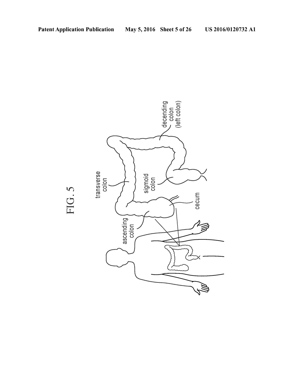 THERAPEUTIC UNDERGARMENTS FOR THE TREATMENT OF FUNCTIONAL GASTROINTESTINAL     DISORDERS INCLUDING IRRITABLE BOWEL SYNDROME - diagram, schematic, and image 06