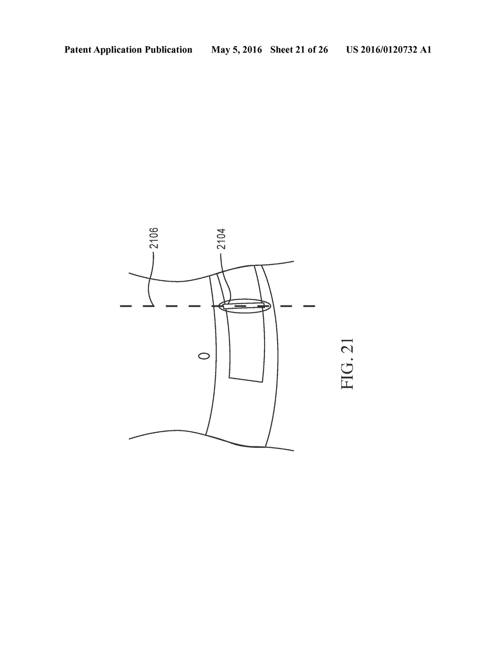 THERAPEUTIC UNDERGARMENTS FOR THE TREATMENT OF FUNCTIONAL GASTROINTESTINAL     DISORDERS INCLUDING IRRITABLE BOWEL SYNDROME - diagram, schematic, and image 22