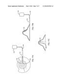 BREASTFEEDING APPARATUS SYSTEM diagram and image