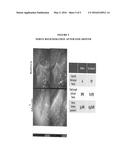 COMPOSITIONS AND METHOD FOR PROMOTING NERVE GROWTH AND REGENERATION diagram and image