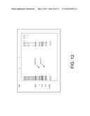 TREATING A LYMPHOMA WITH A WHOLE, LEECH SALIVA EXTRACT diagram and image