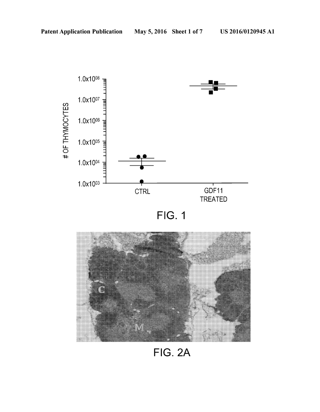 Thymic Regeneration - diagram, schematic, and image 02