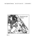 IL-12 COMPOSITIONS AND METHODS OF USE IN HEMATOPOIETIC RECOVERY diagram and image