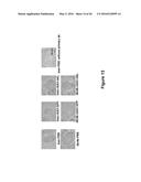 Use of Klotho Nucleic Acids or Proteins for Treatment of Diabetes and     Diabetes-Related Conditions diagram and image