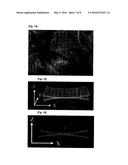 Antiadhesive Kit and Method of Adhesion Prevention diagram and image